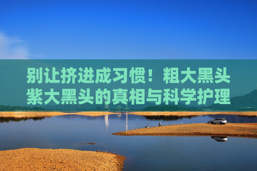 别让挤进成习惯!粗大黑头紫大黑头的真相与科学护理指南,别让挤黑头成习惯!粗大、紫大黑头的真相与科学护理 别让挤进成习惯!粗大黑头紫大黑头的真相与科学护理指南,别让挤黑头成习惯!粗大、紫大黑头的真相与科学护理